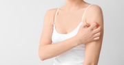 Allergic Reactions from Laser Hair Removal: Explained