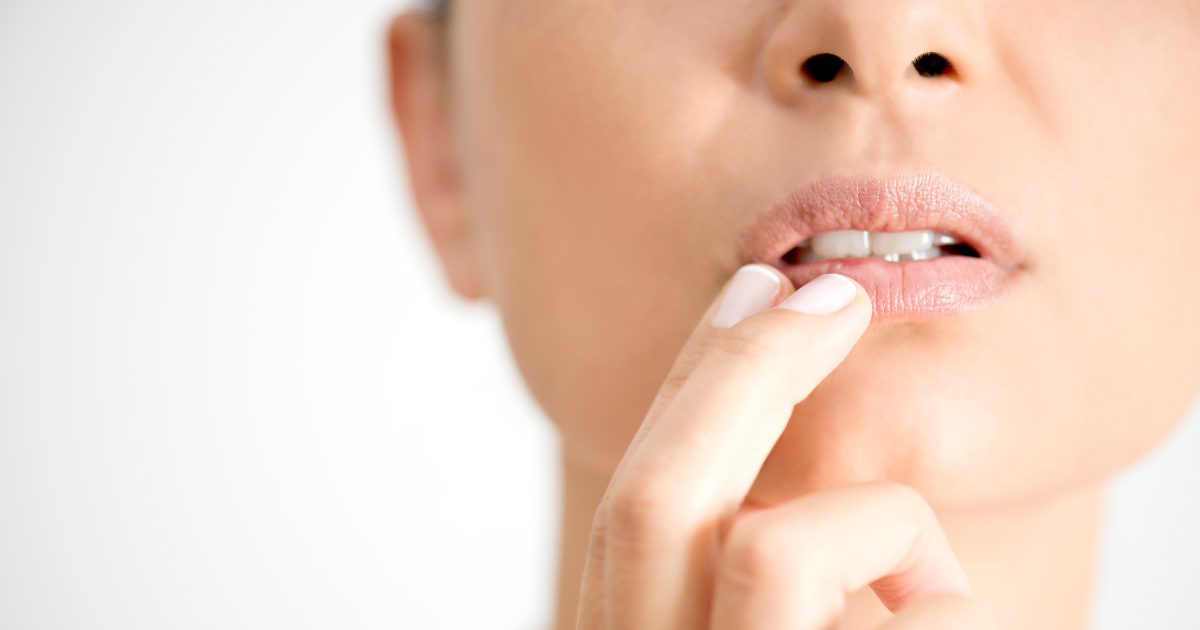 herpes and laser hair removal