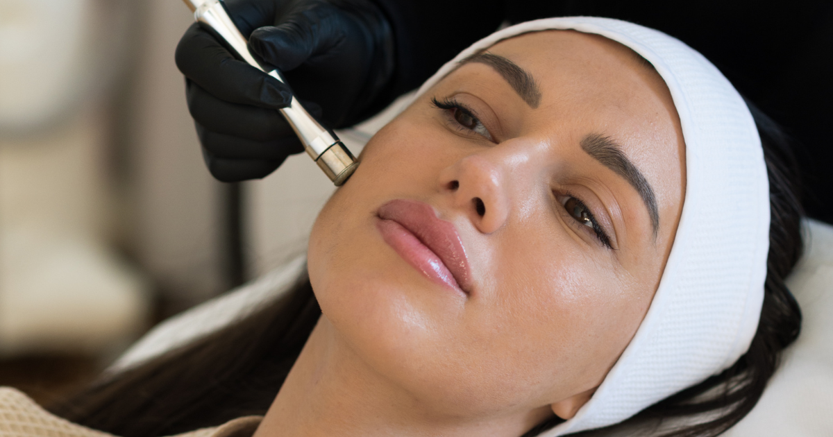 Microdermabrasion shops