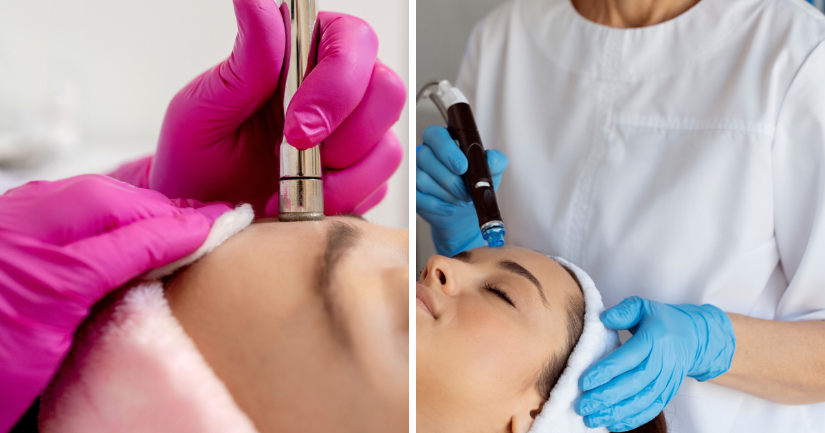 microdermabrasion vs hydrafacial