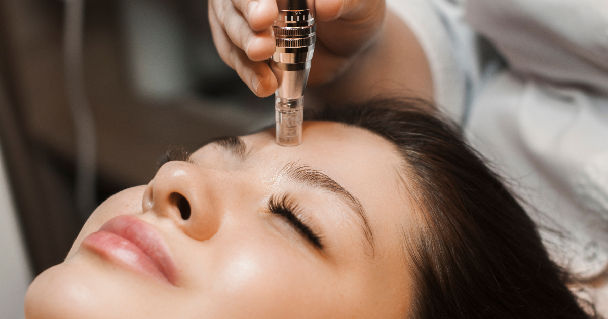 nano infusion vs. microneedling facial