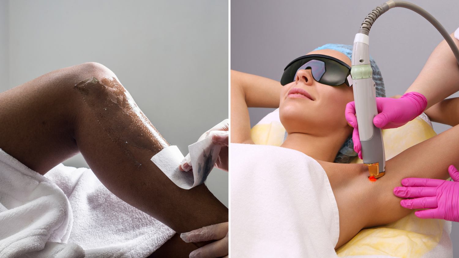 Why Laser Hair Removal is Better Than Waxing