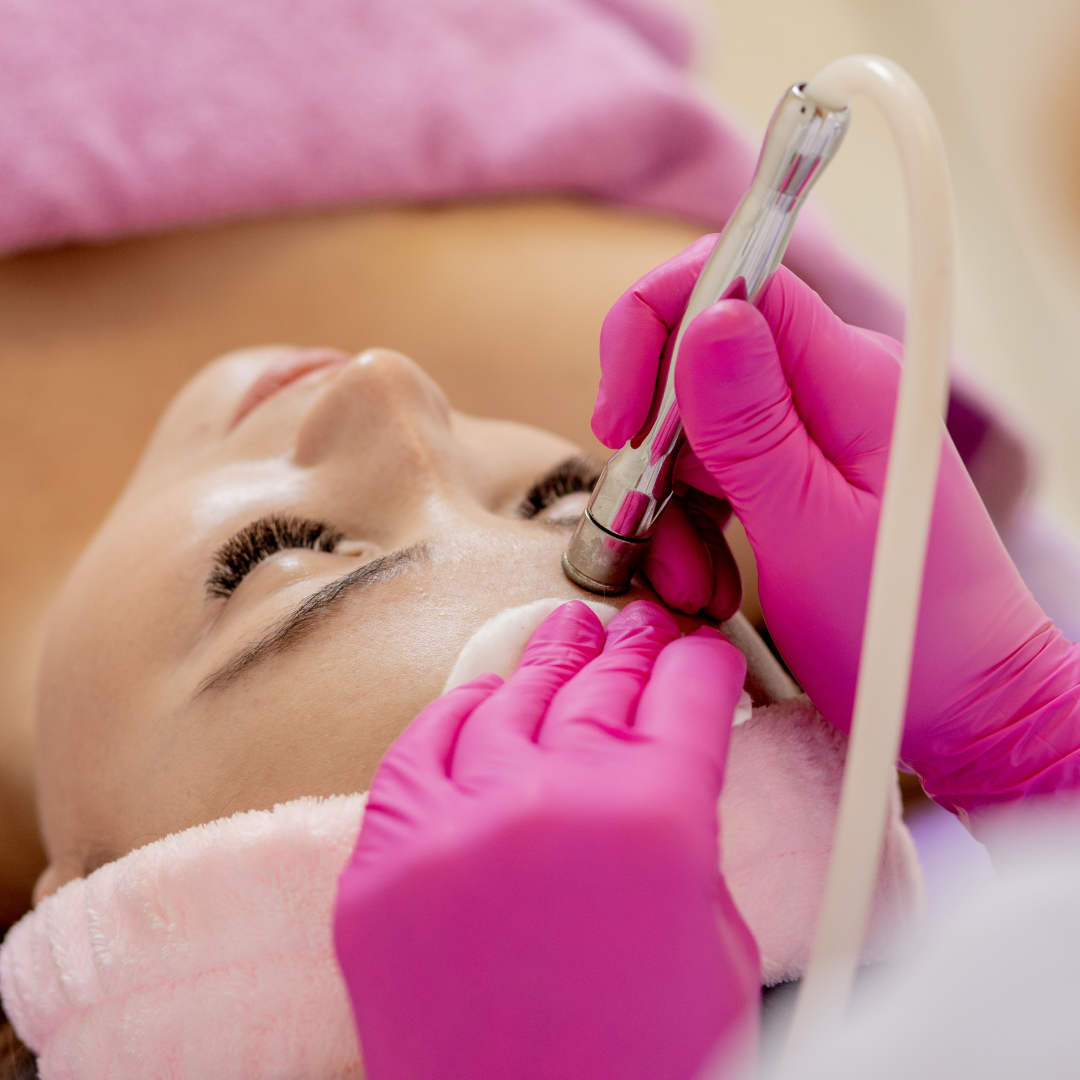Microdermabrasion Facial Brooklyn NYC Aesthetic Allure