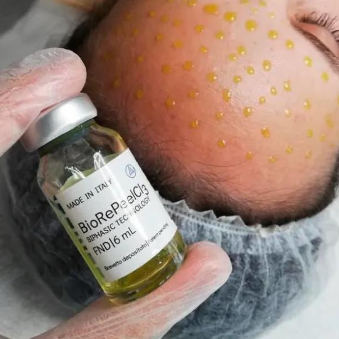 Brooklyn Chemical Peel Facial | BioRePeel® – Aesthetic Allure