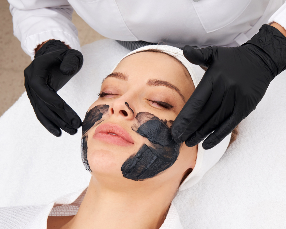 carbon laser peel brooklyn nyc - aesthetic allure