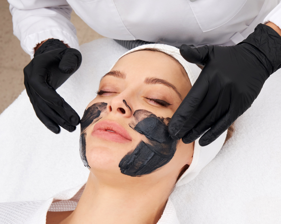 carbon laser peel brooklyn nyc - aesthetic allure 