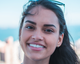 chemical peel customer review- aesthetic allure