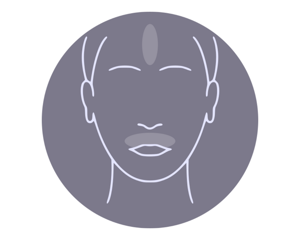 laser hair removal upper lip