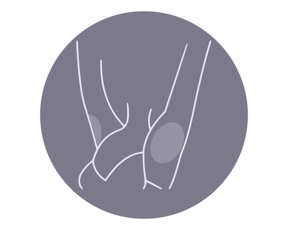 Under the arms Laser Hair Removal