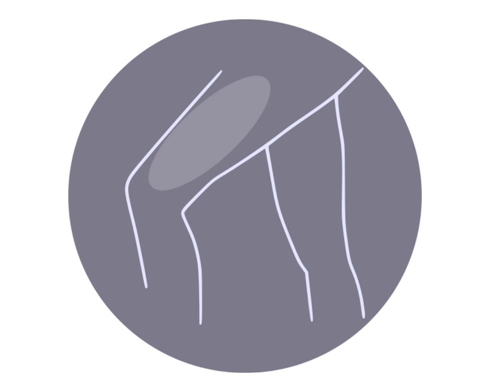 Upper legs laser hair removal