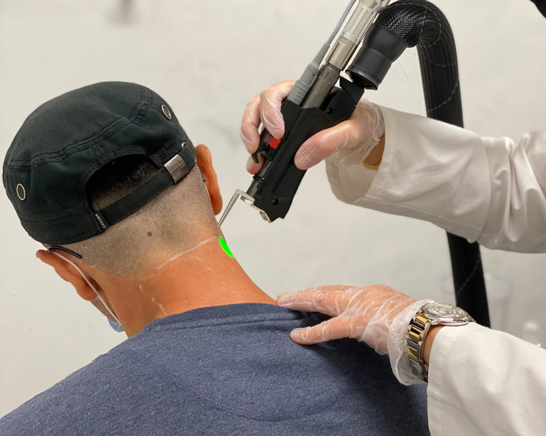 Face and Neck laser hair removal treatment for men