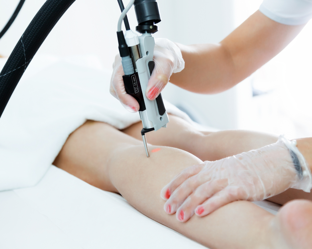 taking care of your skin after laser hair removal