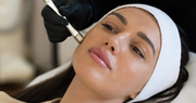 woman getting a microdermabrasion facial for pigmentation