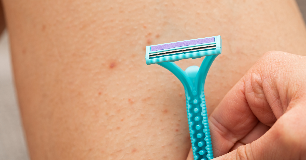 Laser Hair Removal and Strawberry Legs Aesthetic Allure