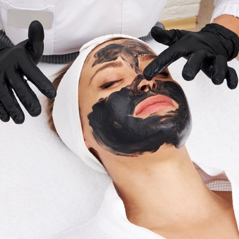 Carbon Laser Peel