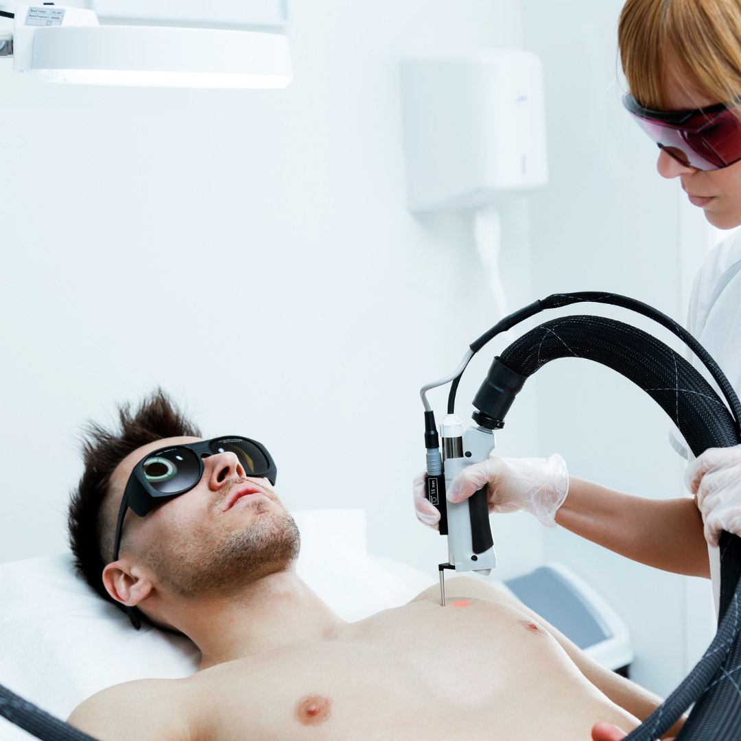 laser hair removal for men nyc, aesthetic allure