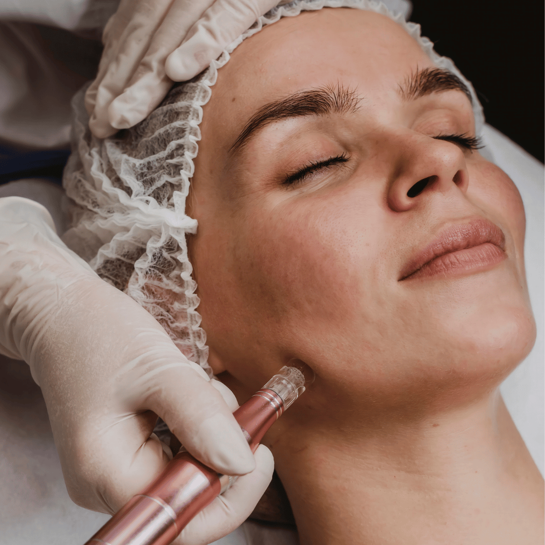 Person receiving a pdrn facial treatment with a gloved hand holding a tool.
